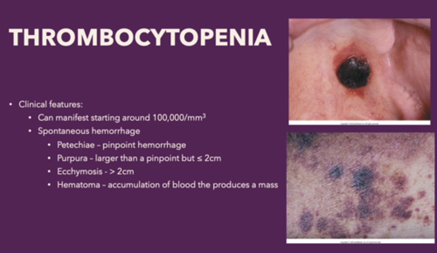 <p>Petechiae</p>