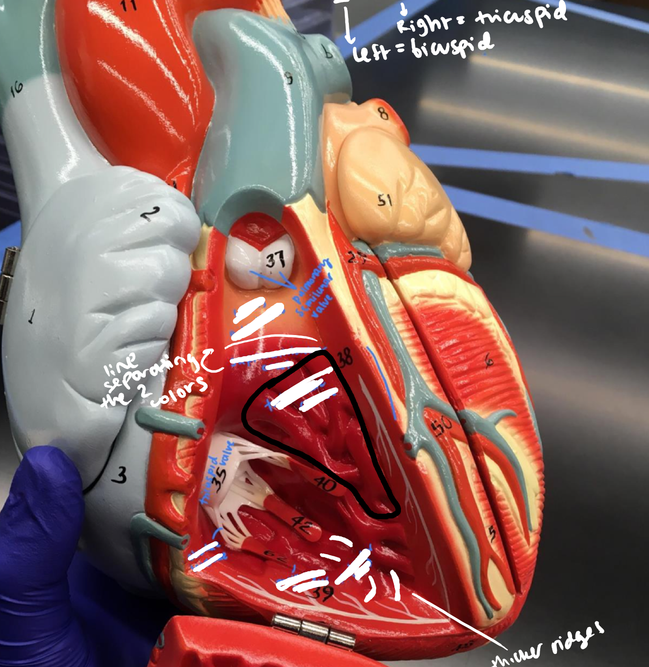 <p>The veiny red meat under the pulmonary semilunar valve</p>