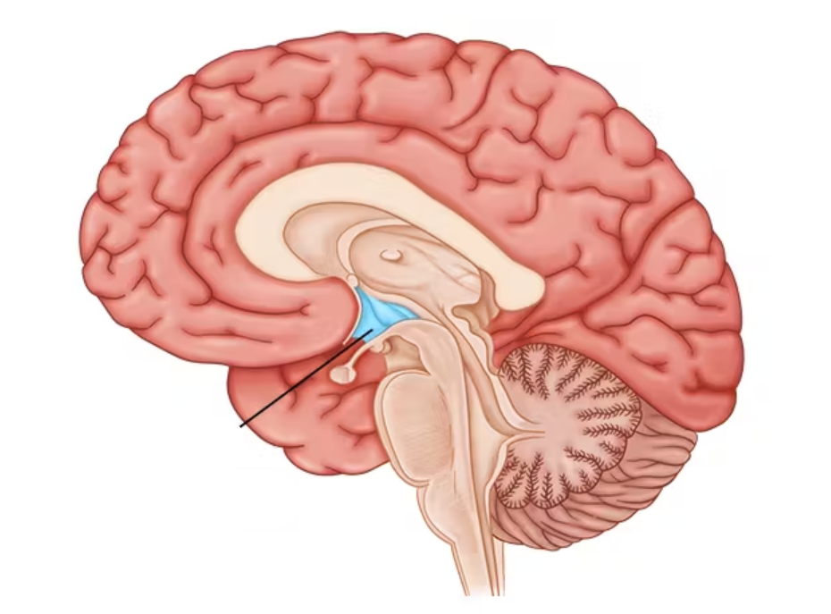 term image