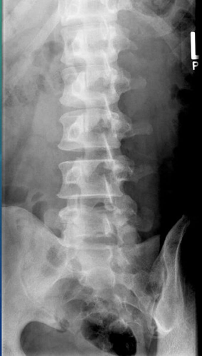 <p>What projection view is this?</p>