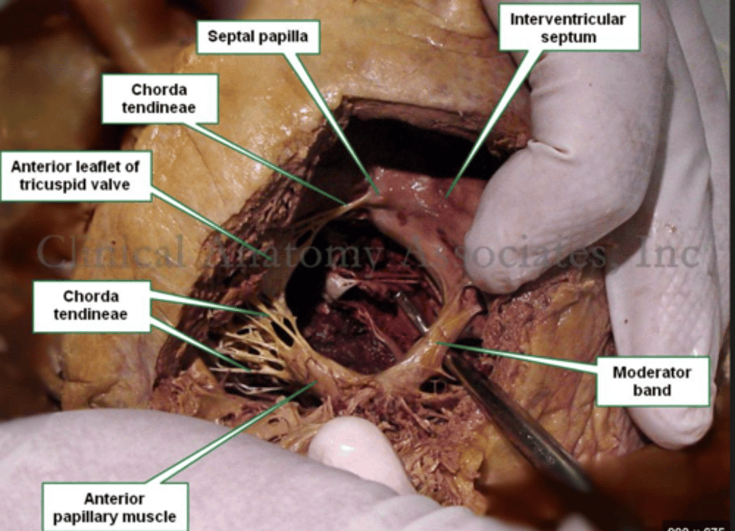 <p>Allows the wave to reach the papillary muscles, inducing their contraction simultaneously with that of the ventricles.</p><p>REMEMBER: PAPILLARY MUSCLES ACT THROUGH THE CHORDAE TENDINAE TO CONTROL THE TRICUSPID AND MITRAL VALVES.</p>