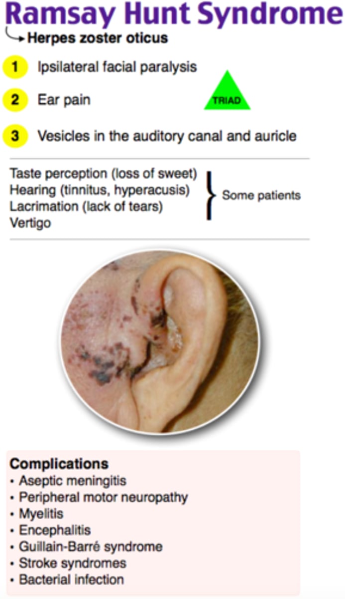 <p>Caused by reactivation of Varicella in the GENTICULATE GANGLION OF CN 7 + 8</p><p>Essentially there is a herpetic infection of these cranial nerves</p>