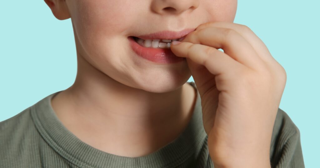 <p>bite bit bitten</p>