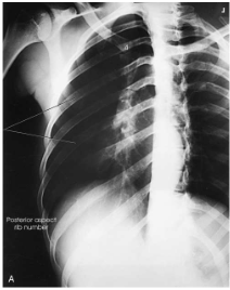 <p>What projection, position and anatomy is this?</p>