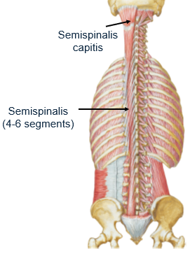<p>superior nuchal line</p>