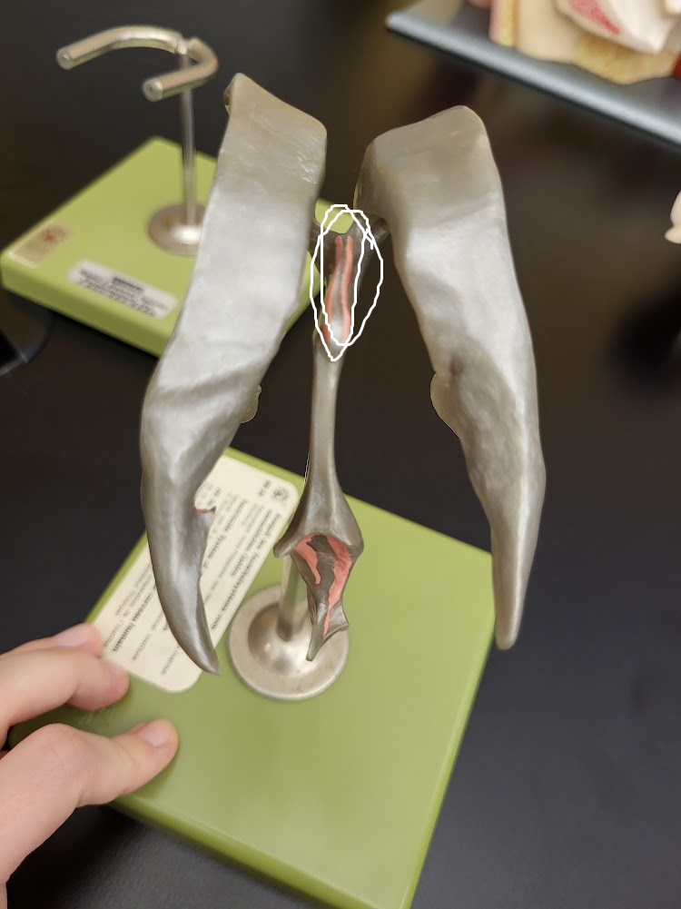 <p>“middle part” of the brain’s ventricular system, containing a “hole” in the middle</p>