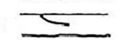 <p>Which ridge line is this?</p>