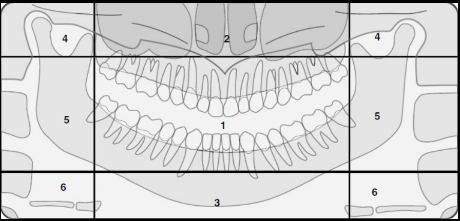 <p>Identify The Zones.</p>