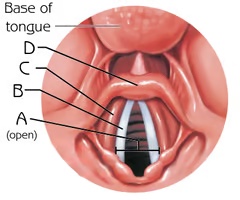 <p>Epiglottis (View 3)</p>