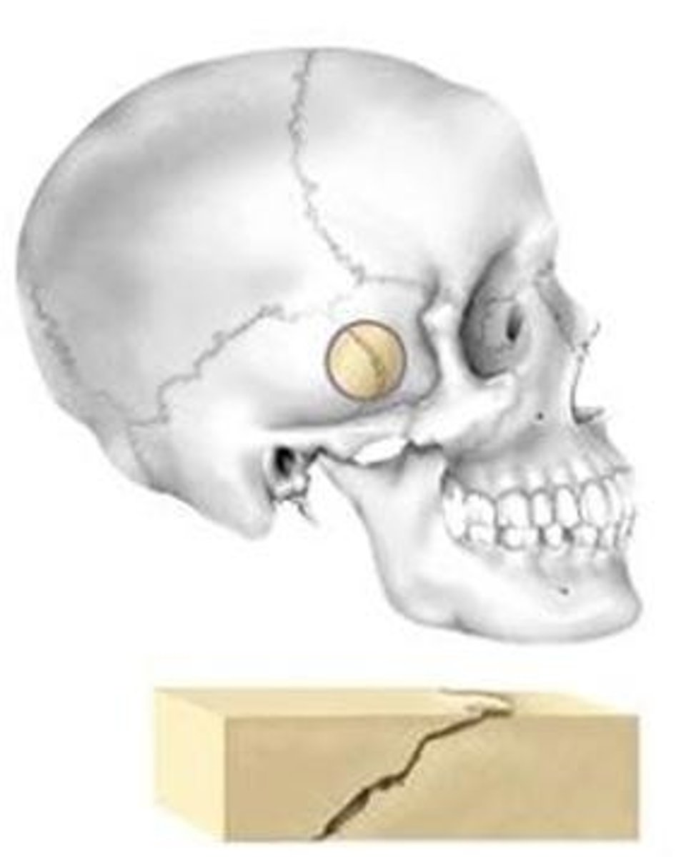<p>overlapped</p>