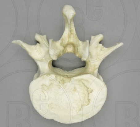 <p>Which Vertebrae is this? </p>