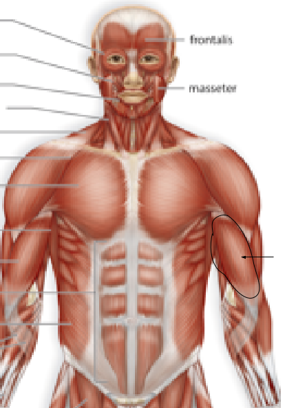 <p>Name the muscle:</p>