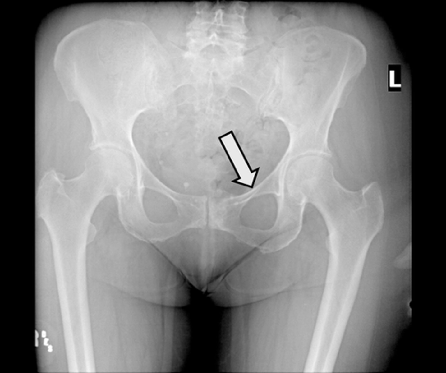 <p>What is indicated in the image?</p>
