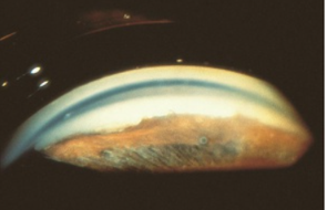 <p>identify </p>