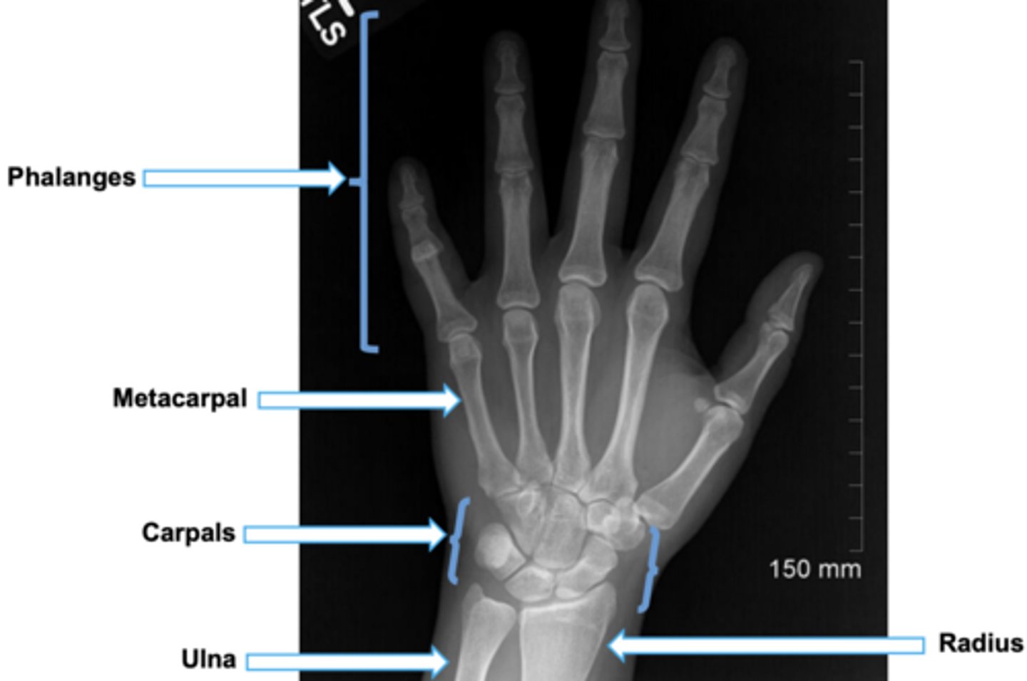 <p>yes, ik the human hand anatomy</p>