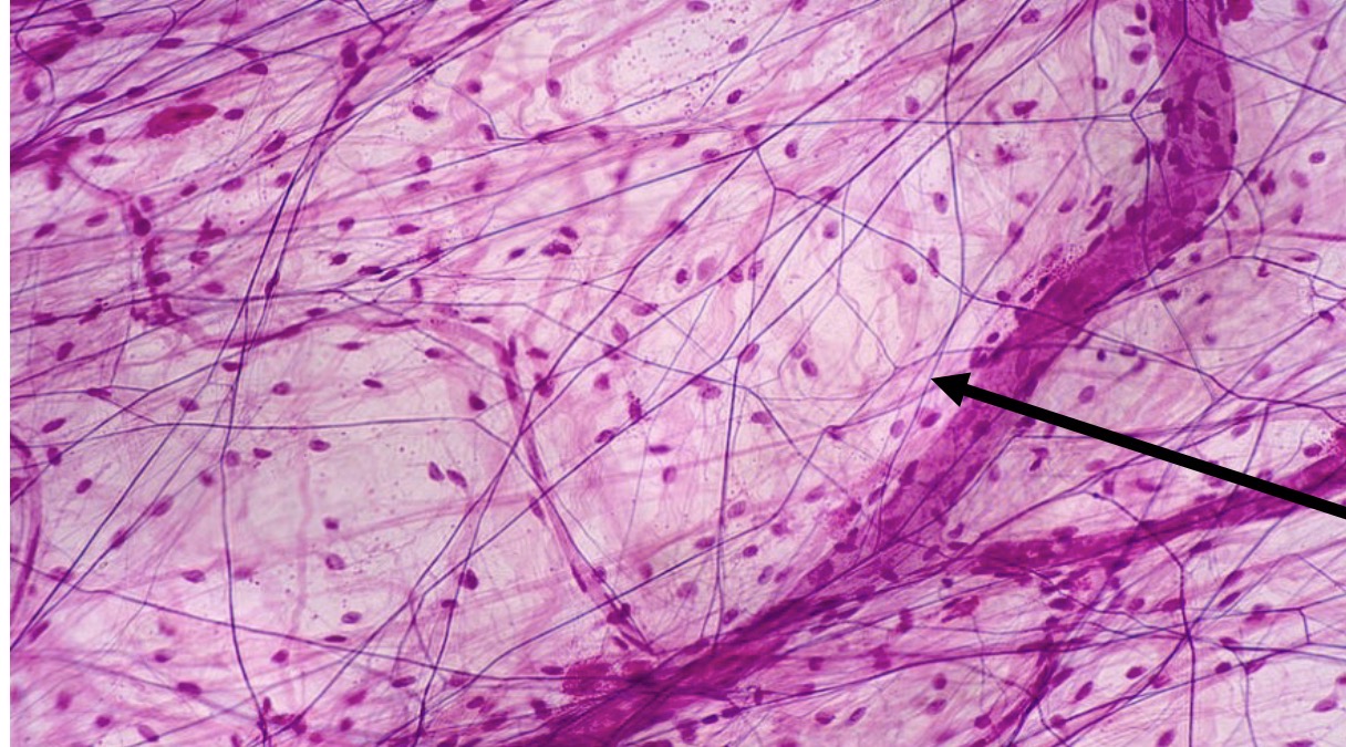<p>Identify the type of tissue and the<br>structure at the arrow</p>