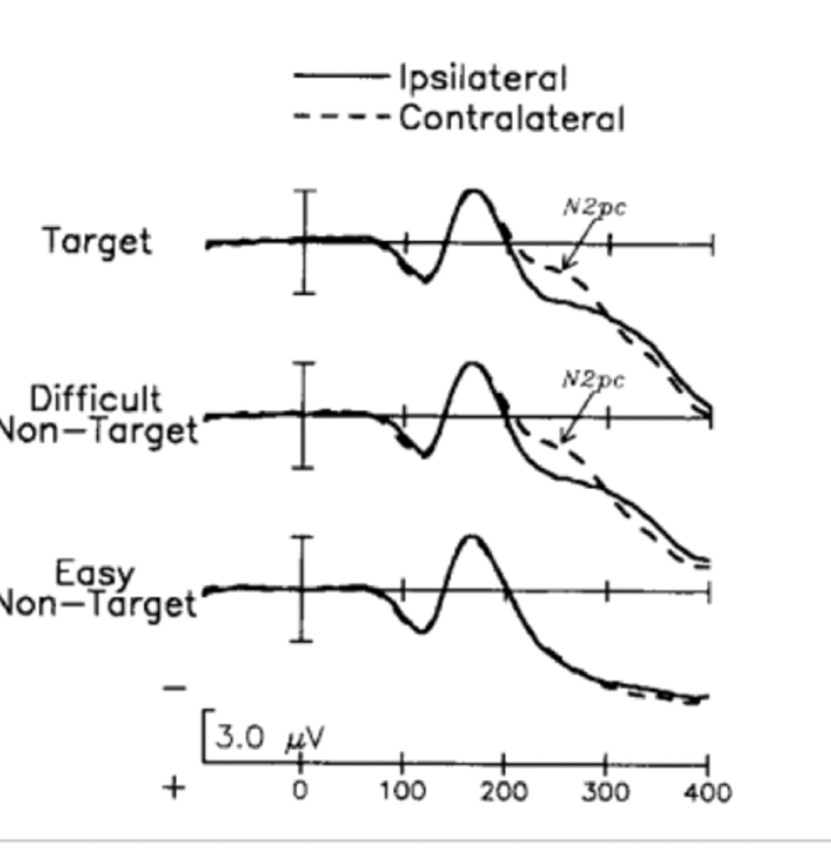 <p>What: ERP component seen after the presentation and response to a visual stimulus <br>Where: PO7/PO8 of contralateral side to stimulus (from difference wave) <br>Why: focusing of visuospatial attention (either distractor suppression or target processing)</p>