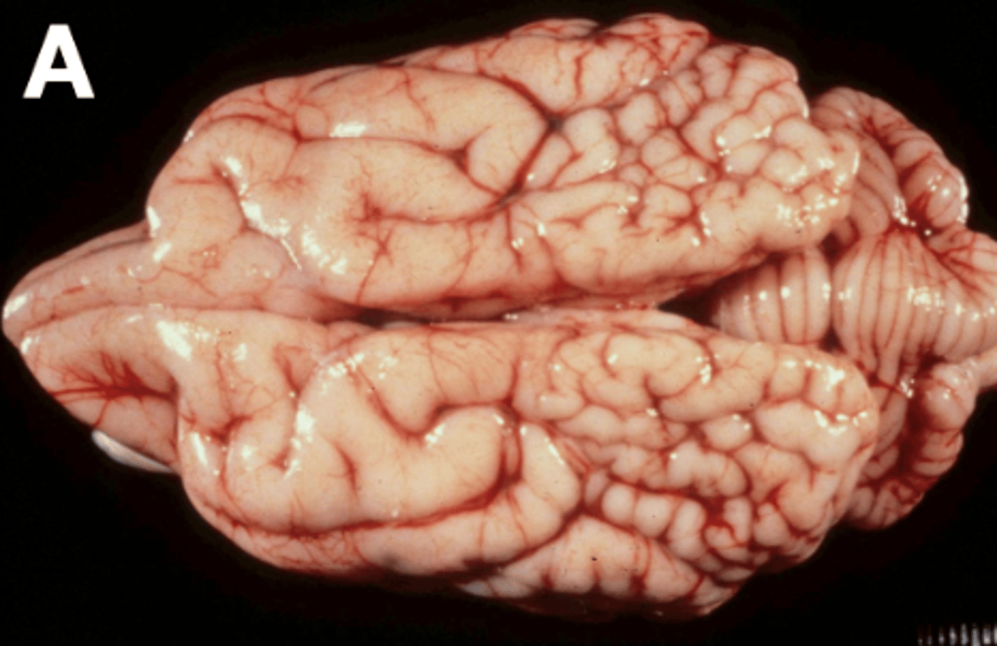 <p>- Many small gyri</p>