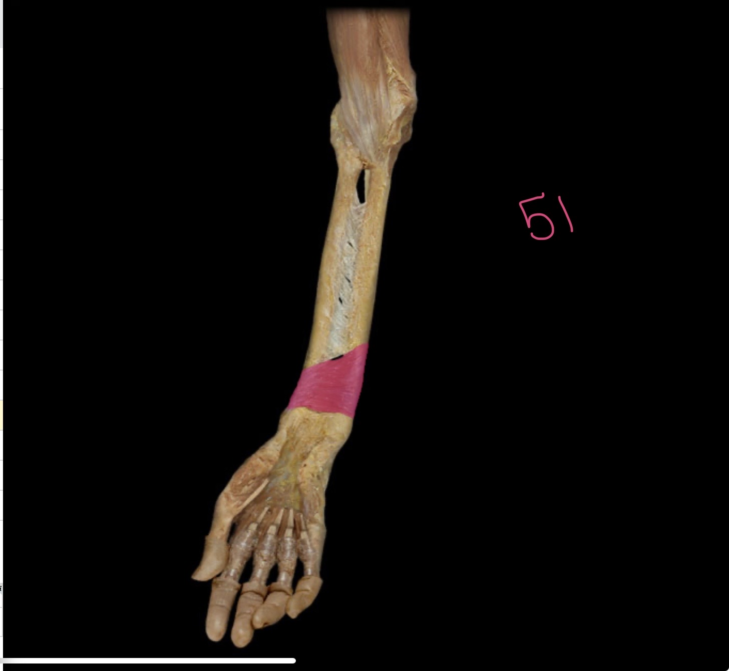 <p>Pronator quadratus</p>