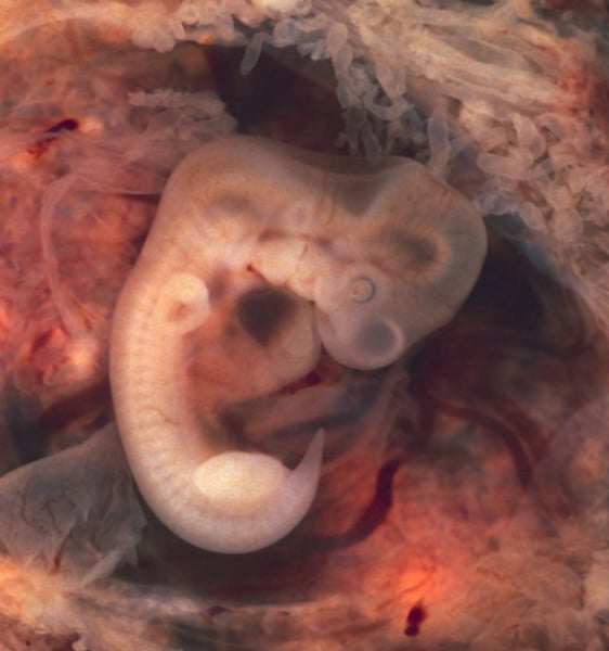 <p>Embryo</p>