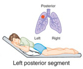 <p>What CPT position is pictured, and when is it used?</p>