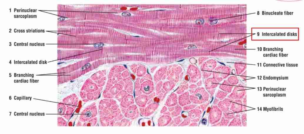 <p>It has involuntary control, one or two nuclei per cell, and intercalated discs.</p>