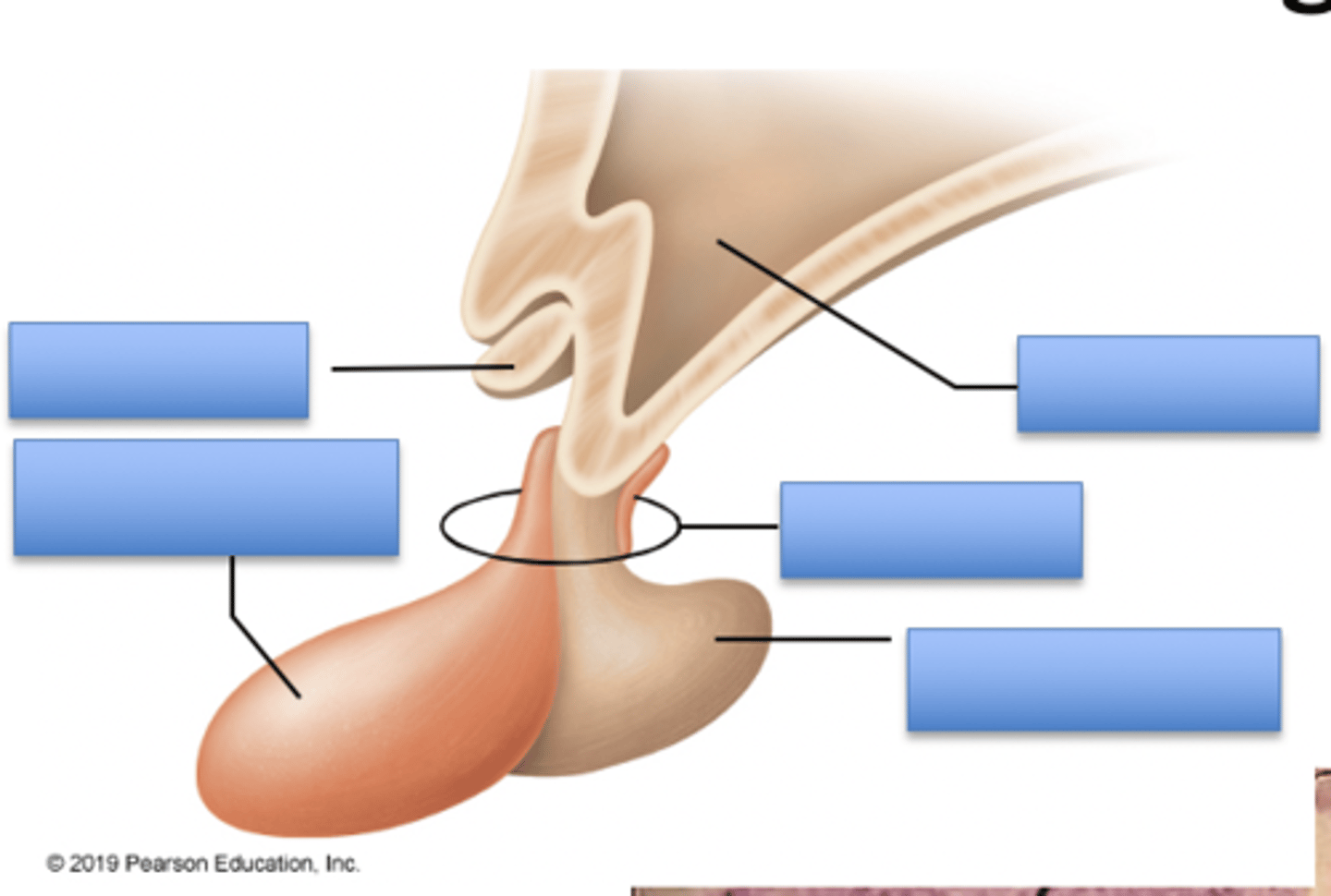 <p>right side</p><p>Hypothalamus</p><p>infundibulum</p><p>posterior pituitary (neurohypophysis)</p><p>left side</p><p>optic chiasma</p><p>Anterior pituitary (adenohypophysis)</p>