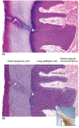 <p>Multiple cell layers with cells becoming increasingly flat and scaly toward surface; surface covered with a layer of compact dead cells without nuclei; basal cells may be cuboidal to columnar</p>