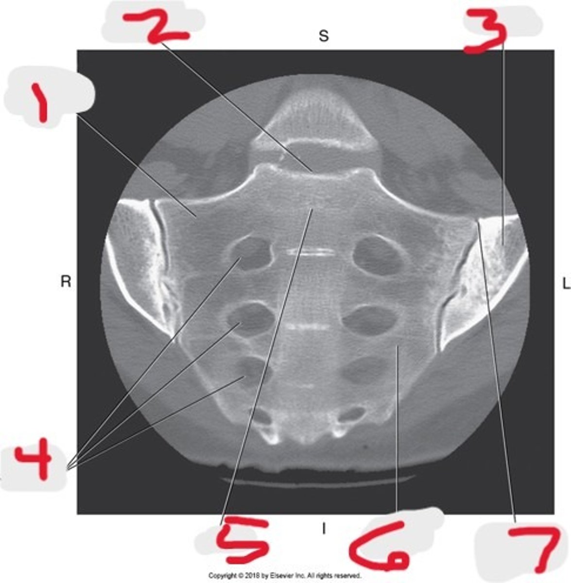 <p>Name all numbered structures</p>