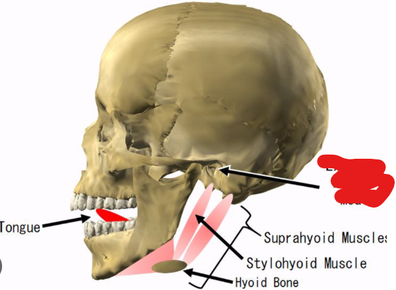 <p>What landmark in the <strong>Temporal Region </strong>is this?</p>