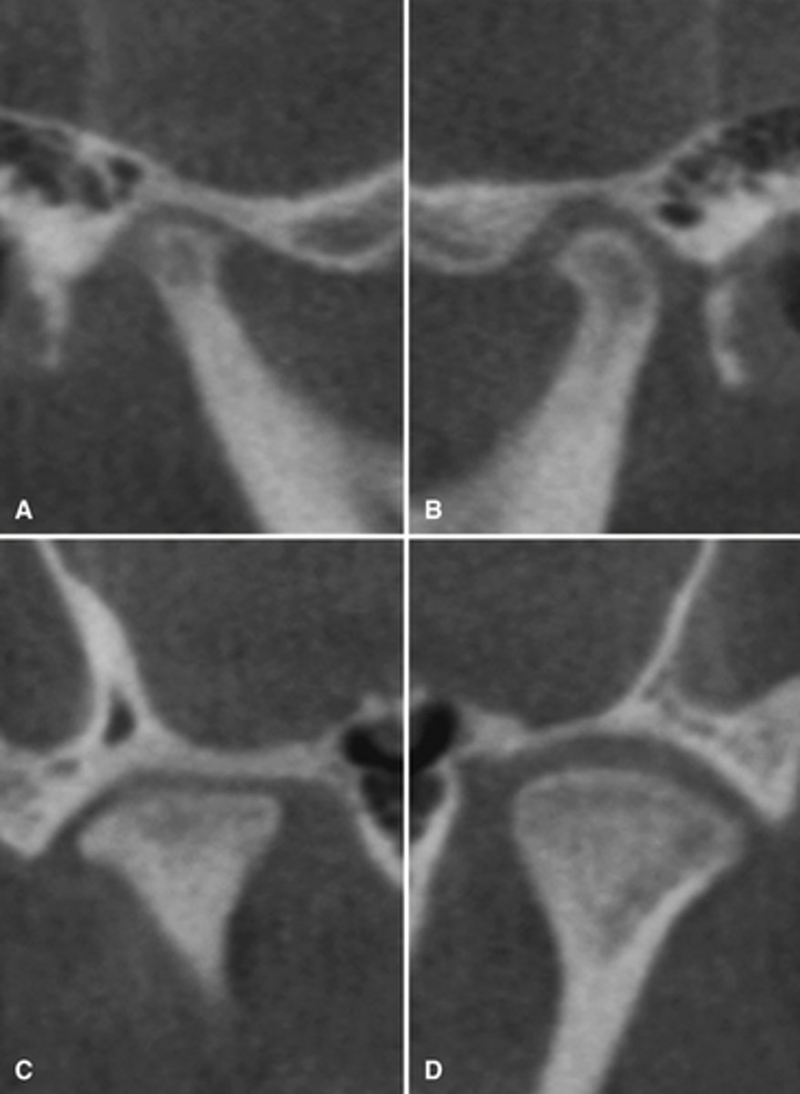 <p>What is this developmental abnormality?</p>
