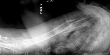 <p>name position/projection; in what position is the beam in? what position is the patient in? is there a breathing technique present?</p>