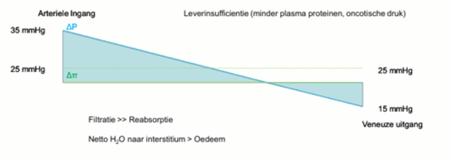 <p>- Minder plasmaproteïnen aangemaakt, waardoor oncotische druk daalt</p>