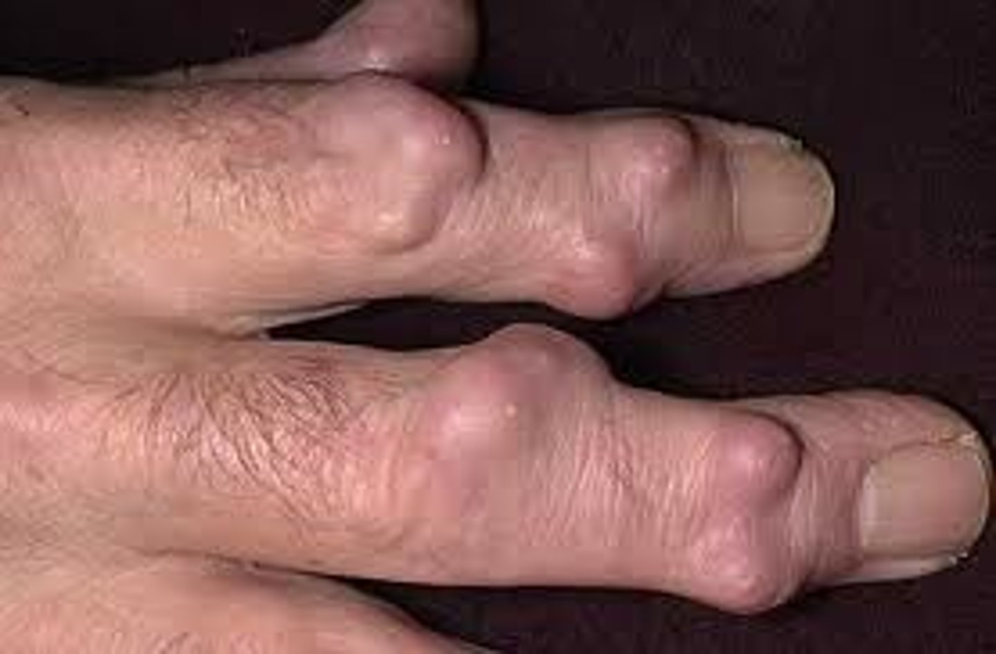 <p>small joints affected 1st</p><p>joint swelling</p><p>rheumatoid nodules</p><p>fatigue (usually later in the day)</p><p>weakness</p><p>low grade fever</p><p>musculoskeletal pain</p><p>joint stiffness (usually 30+ mins in the morning)</p>