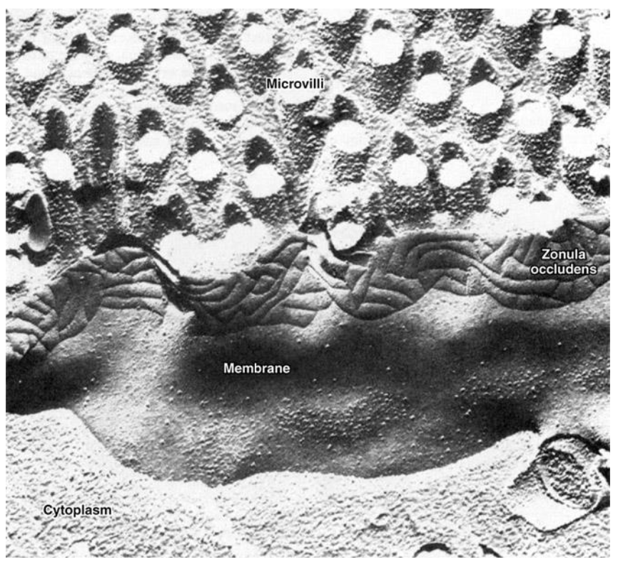 <p><span>They surround the whole cell in a "quilted" pattern</span></p>