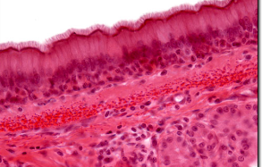 <ul><li><p><span style="background-color: transparent; font-family: "Book Antiqua", serif;"><span>One layer but appear as more because so closely compacted together</span></span></p></li><li><p><span style="background-color: transparent; font-family: "Book Antiqua", serif;"><span>Cilia on free surface</span></span></p></li><li><p><span style="background-color: transparent; font-family: "Book Antiqua", serif;"><span>Nuclei found in different locations</span></span></p></li><li><p><span style="background-color: transparent; font-family: "Book Antiqua", serif;"><span>Found in lungs, pharynx, trachea</span></span></p></li></ul><p></p>