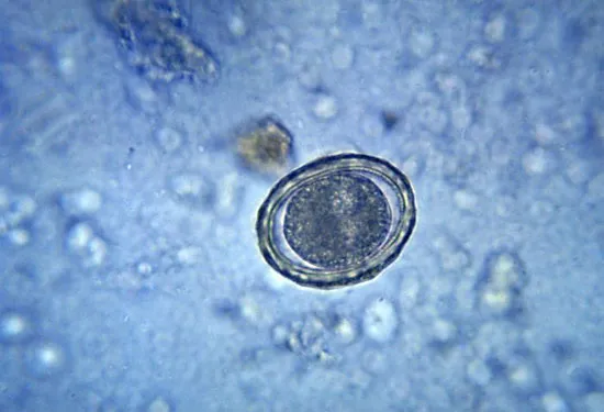 <p>Quel est le nom de la toute première cellule issue de la fécondation d’un ovule par un spermatozoïde ?</p>