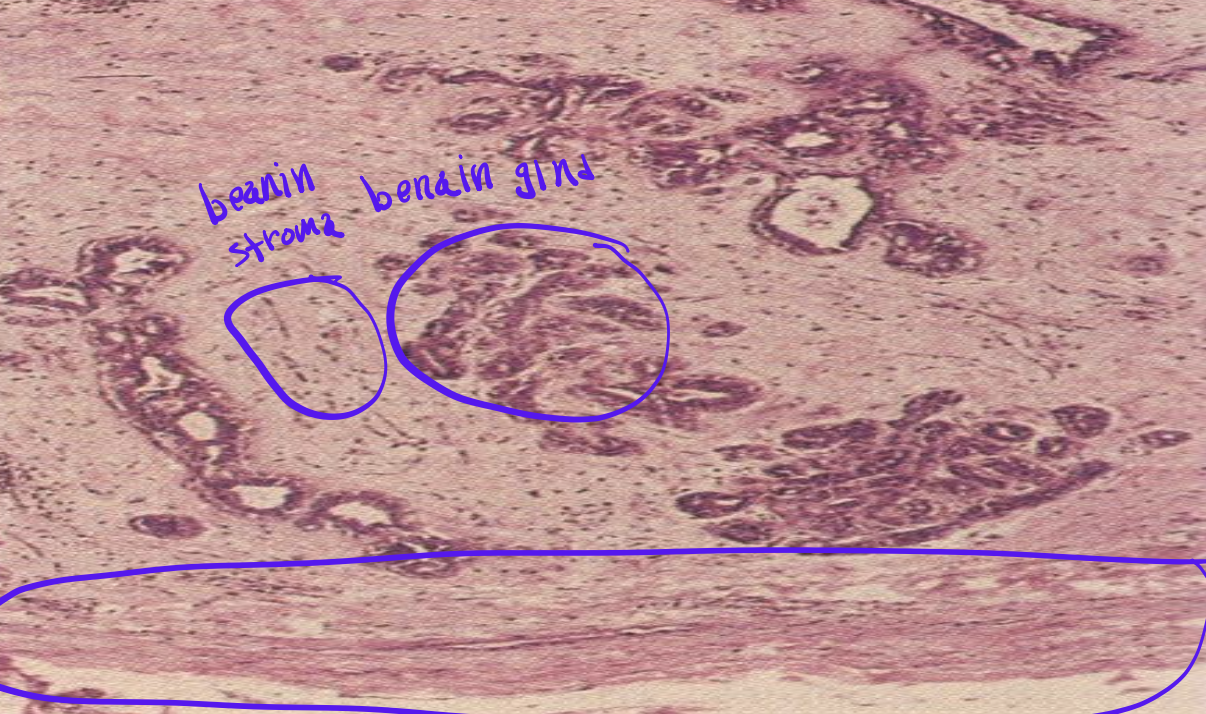 <p>Identify the <strong>organ</strong> and the <strong>diagnosis</strong> in this format: <em>diagnosis, organ</em></p>
