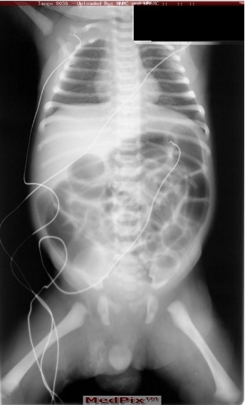 <p>abd xray, CT, colonic transit studies, sitz mark studies</p>
