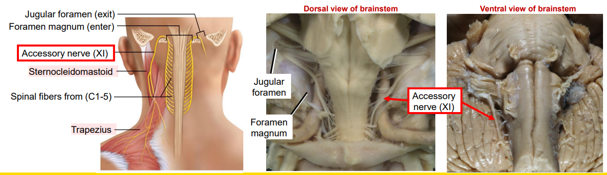 <ul><li><p>Function: MOTOR</p><ul><li><p>Nucleus Ambiguus: Muscles of the pharynx for speech and swallowing</p></li><li><p>Spinal Accessory Nucleus: SCM and Trapezius motor function</p></li></ul></li></ul><p></p>