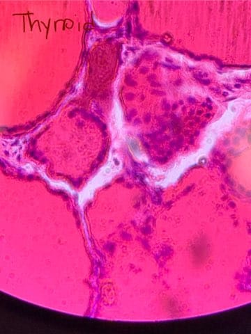 <p>Identify this slide.</p>