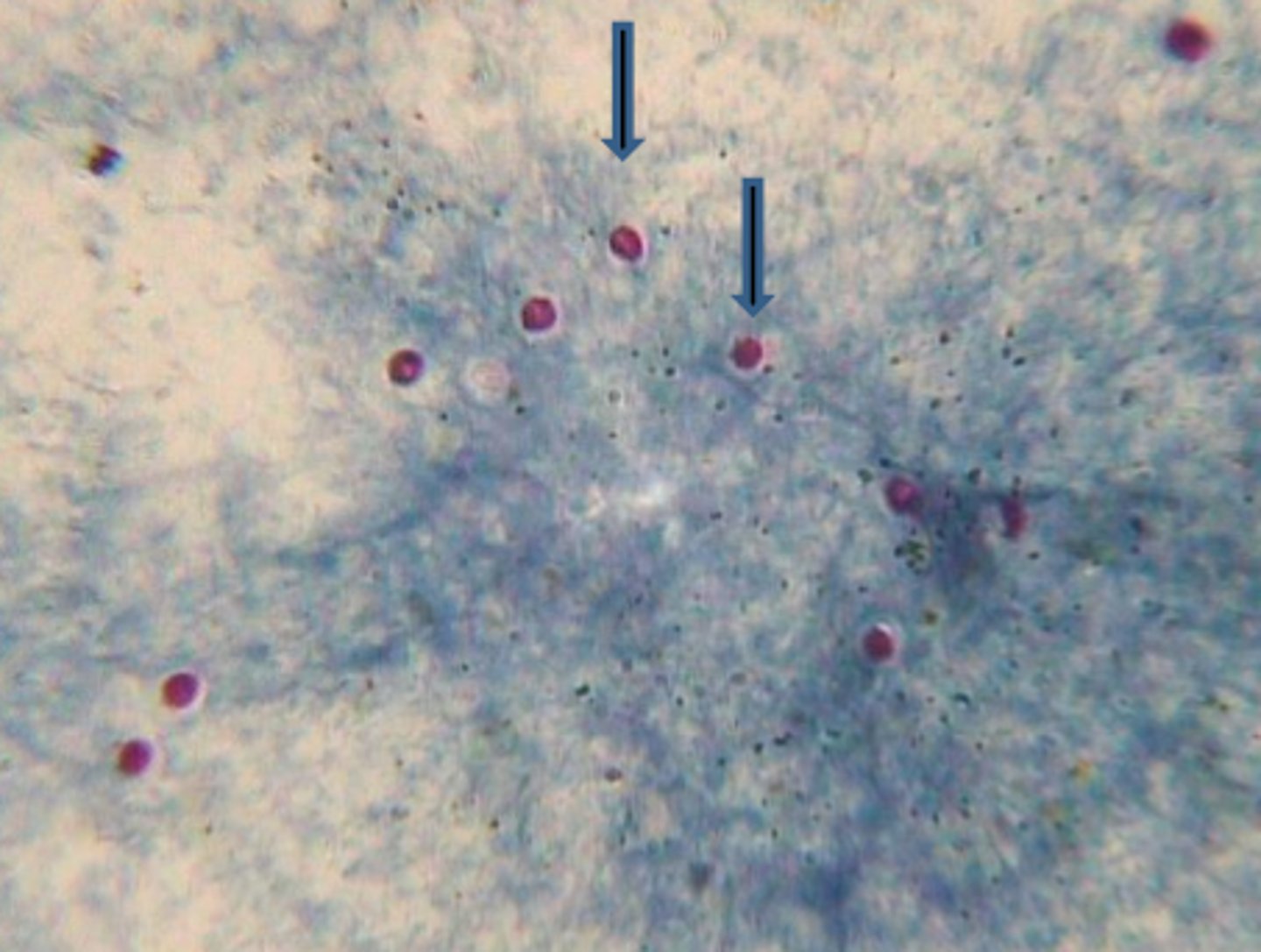 <p>smallest</p>