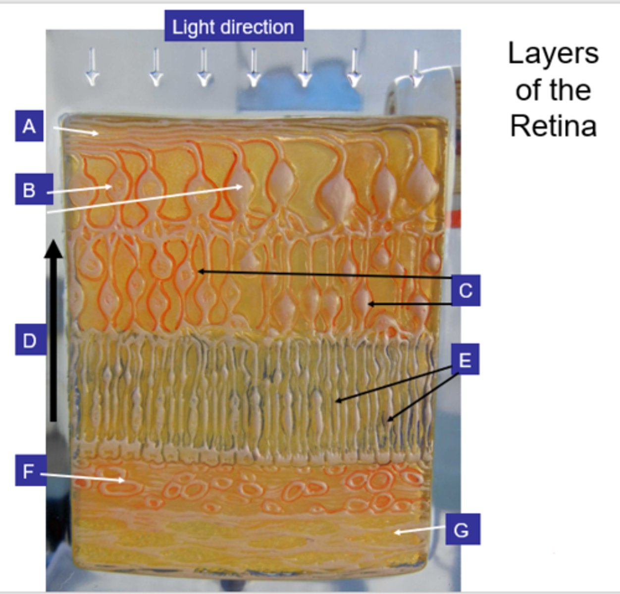 <p>What structure is the letter B?</p>