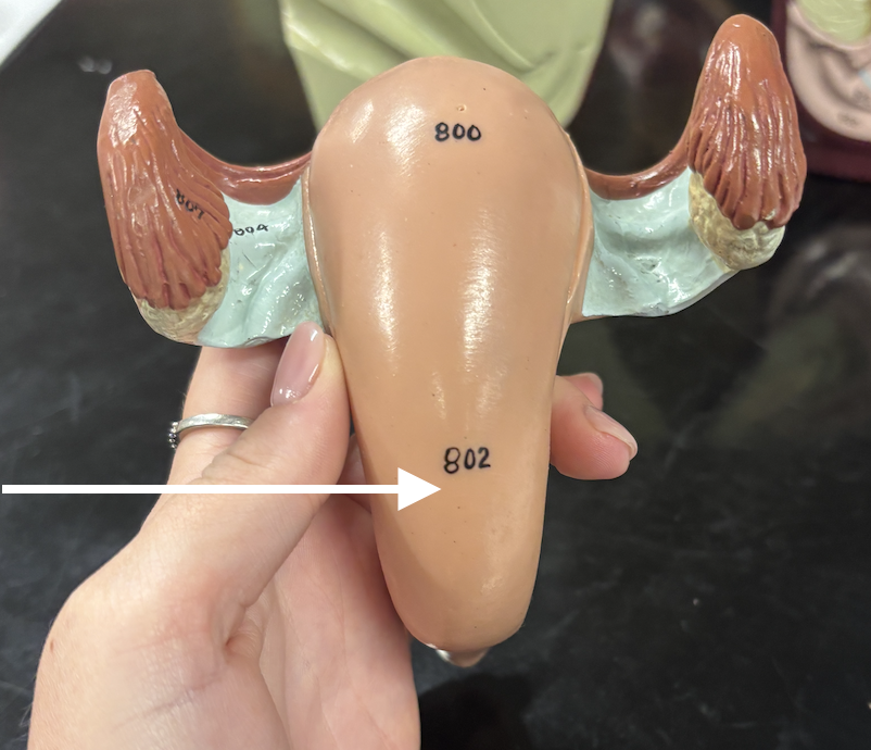 <p>what structure is the arrow pointing to? </p>