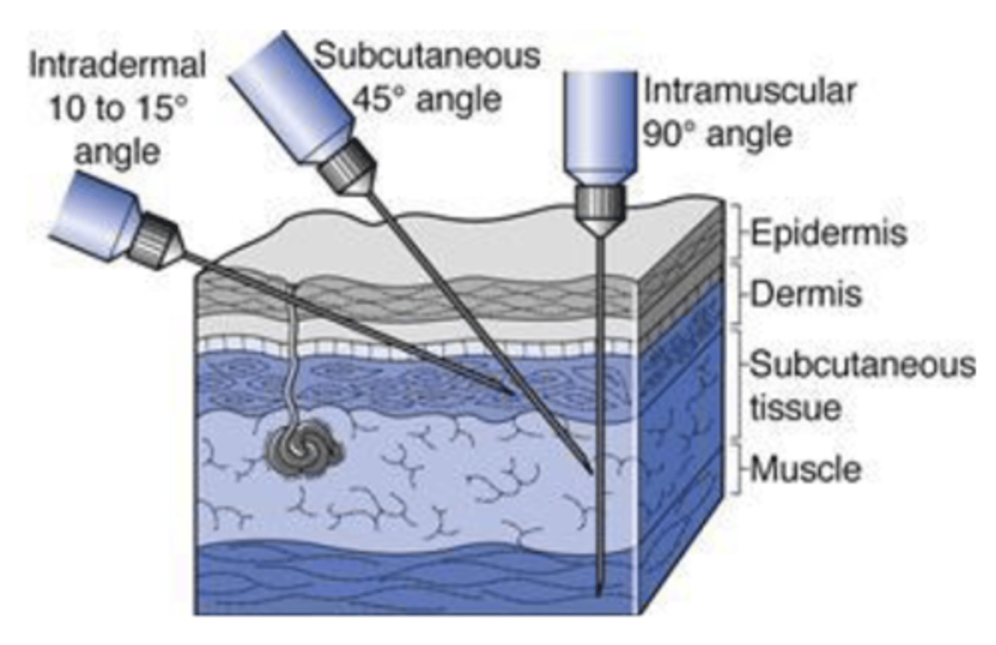 <p>- less rapid but longer lasting than IV- second only to IV route in rapidity of onset of action</p><p>- more rapid than PO</p><p>- injection site is deep in skeletal muscle</p><p>- 0.5-2 mL</p>