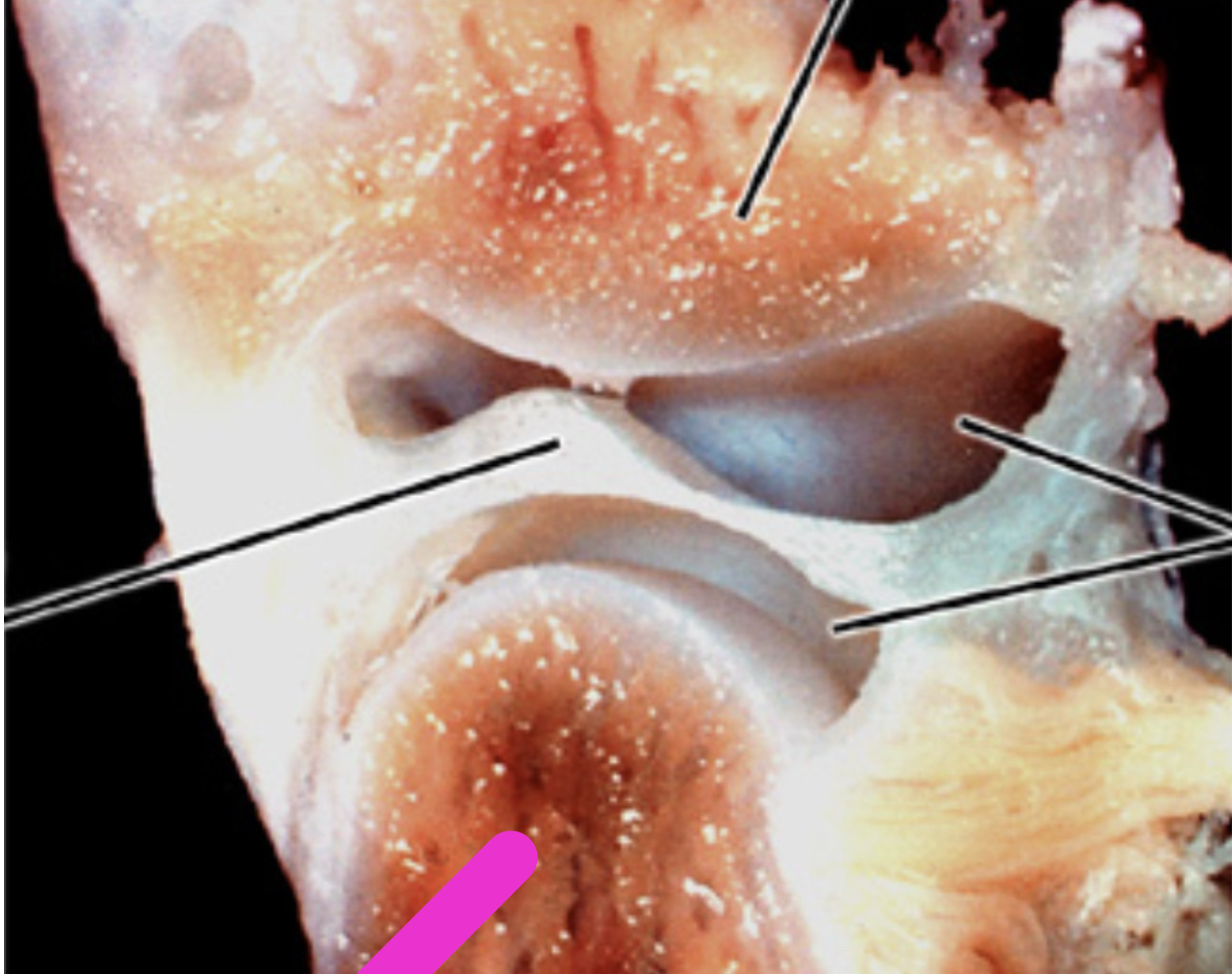 <p>Identify the structure</p>