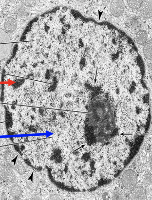 <p>What part of the nucleus is being shown by the red arrow?</p>