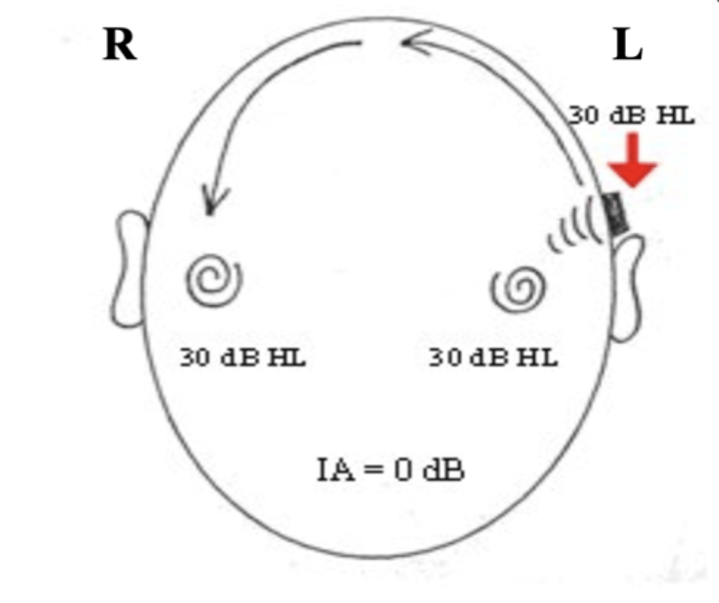 <p>- since the BC oscillator actually vibrates the entire skull, placing it at any place on the skull can stimulate either cochlea.</p><p>- therefore, the inter aural attenuation for bone conduction testing is 0 dB.</p><p>THERE IS NO LOSS OF SOUND ENERGY, THE SAME AMNT OF ENERGY REACHES BOTH COCHLEAS. THE ENTIRE SKULL IS VIBRATING.</p>