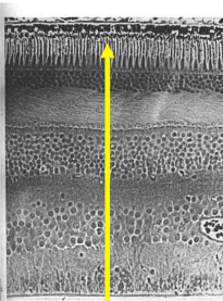 <p>identify the section of a human retina: show the 5 principal cell types and the layers</p>