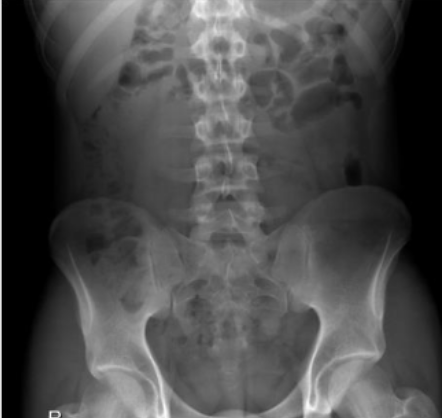 <p>Identify parts of pelvis  (6)</p>